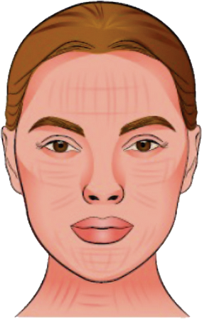 non-alpha-face